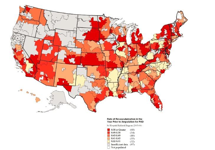 Geographic Revascularization Rates - USA 2003 to 2006 Variation in the Use of Lower Extremity