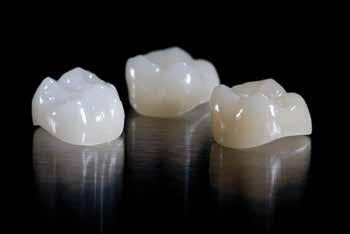 IPS Empress CAD Leucite glass-ceramics IPS Empress CAD is associated with more than 20 years of successful clinical performance.