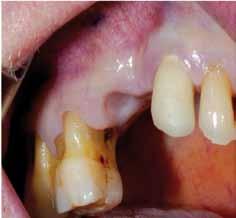 Clinical cases Implantology,