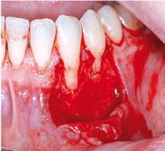 Periodontology, Oral
