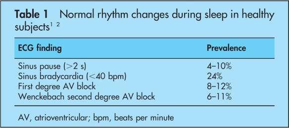 Normal Sleep Rhythm Disturbances ECG Incidence VPS in nolmals