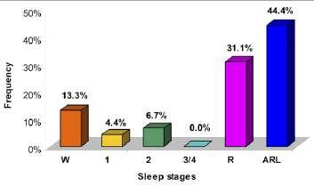 Distribution of ST-segment changes according to changes in sleep stages.