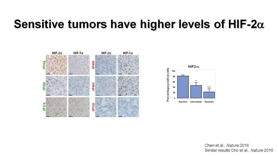 Sensitive tumors have higher levels of HIF-2a Presented