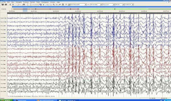 EEG-u Slika 7.