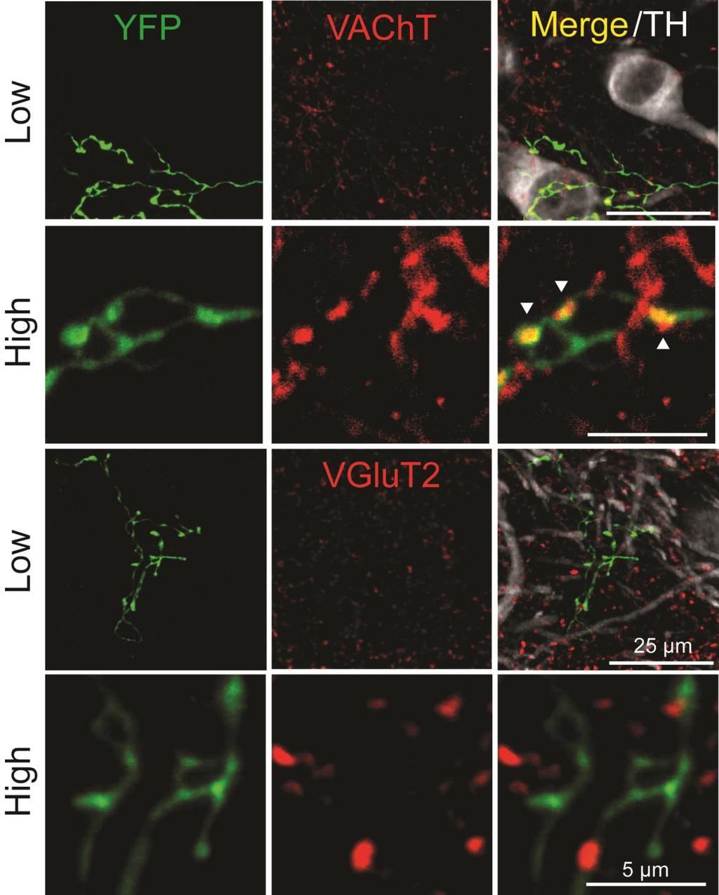 Supplementary Figure 9 Expression of vesicular acetylcholine transporter (VAChT) in YFP-labeled axons.