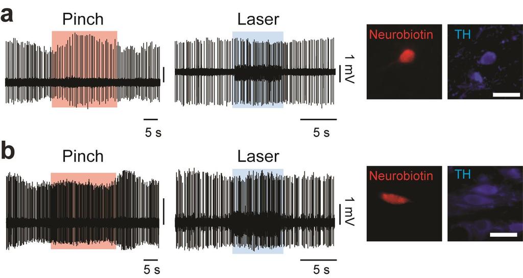 Supplementary Figure 10 Individual response of DA neurons to aversive (pinch) and laser stimulation.