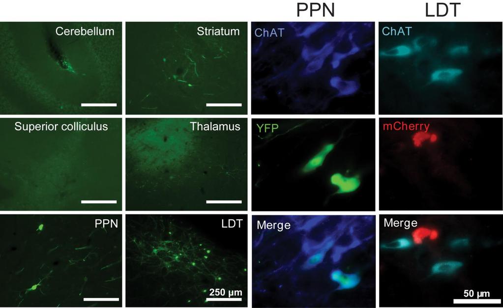 Supplementary Figure 2 Specificity of transduction for cholinergic neurons in different brain areas.