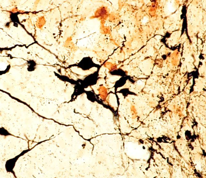 DOPAMINERGIC NEURONS IN THE HYPOTHALAMUS DOUBLE IMMUNOCYTOCHEMICAL LABELING REVEALS BLACK, DOPAMINERGIC NEURONS CONTACTING BROWN,