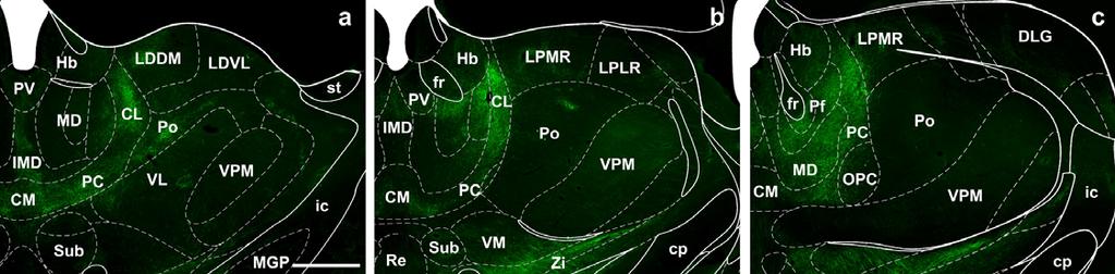 Supplementary Figure 1 Distribution of GlyT2::eGFP fibers in the mouse thalamus at three different coronal levels.