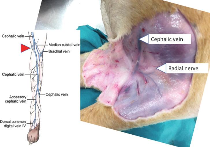 and common digital extensor m (Figure 5). The cephalic vein travels just superficial to the extensor carpi radialis m in the proximal antebrachium.