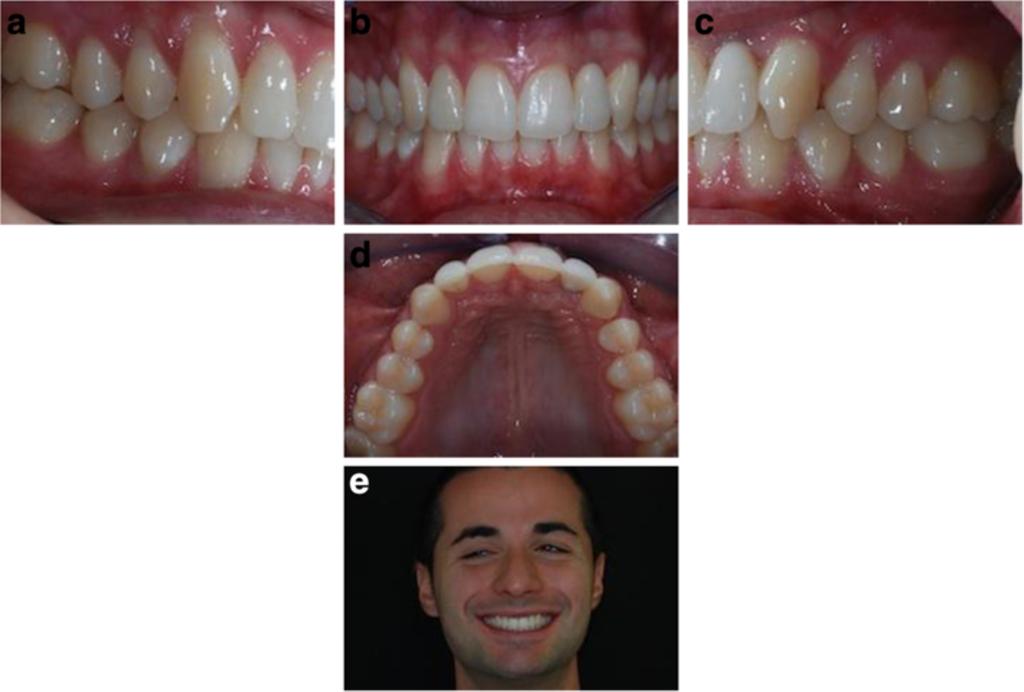 orthodontic treatment records before