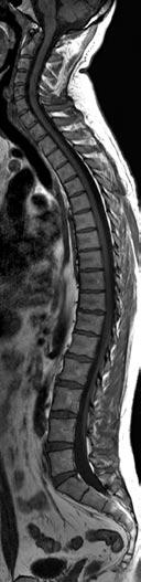 clinical capabilities Single-scan total spine