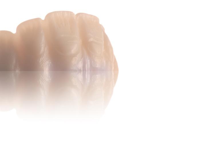 Creator #1 JUNGO ENDO Jungo Endo Dental Studio MANAGEMENT OF GINGIVAL CERAMICS -Creating a Balance between Implant Restoration and Nature- Traditionally an unaesthetic outcome for partially and