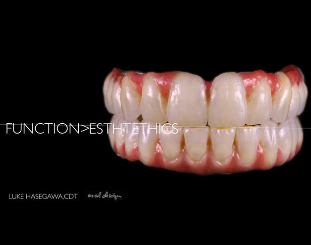 Creator #6 LUKE HASEGAWA Ozark Prosthodontics Smile Design Most dental technician fabricate restorations from a dental lab prescription.that is the standard for our industry.