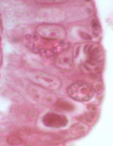 Typical Isospora