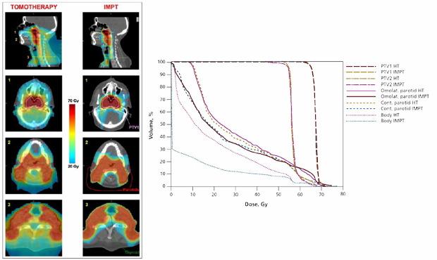 5. PROTON THERAPY PROTON therapy MD Anderson Cancer Centre Randomized phase II III study 360 pats HPV+ OPC concurrent CRT IMRT