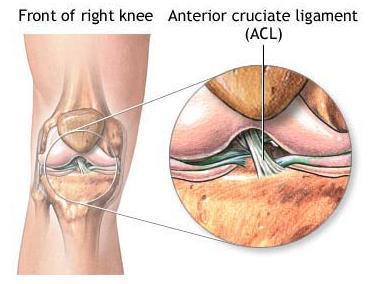 Patella treatment will depend upon whether it the patella has been damaged by general wear or by a structural problem.