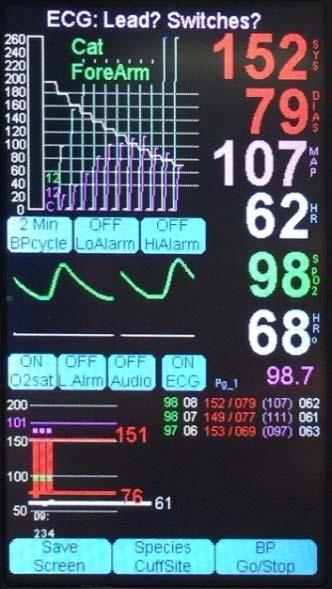 The amplitude or strength is inadequate. Adjust the electrodes, and/or increase the gain. NOTE: The No ECG detected alarm becomes O2 Sensor? ECG? if at the time the no ECG detected alarm is triggered, there is already a SpO2 alarm active.