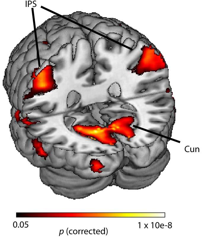 Figure S2: Main effect of monetary stimuli Monetary stimuli, combined across all value levels, evoked greater activation in lateral and medial parietal regions than face stimuli.