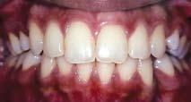 Orthodontics and