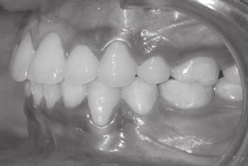18: Posttreatment intraoral mandibular occlusal view anterior teeth (Fig. 19).