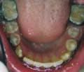 article clinical orthodontics Fig. 5m Fig. 5n Fig. 6k Fig. 6l Fig. 6m Fig. 6n Fig. 5o Fig. 5p Figs.