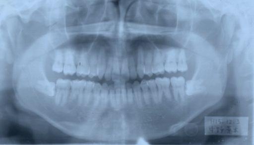 Print on transparent support PERIAPICAL OR PANORAMIC RADIOGRAPHS AT COMPLETION OF