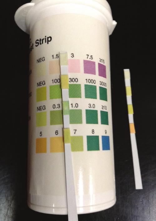OpenStax-CNX module: m64804 3 Figure 1: A urine dipstick is compared against a color key to determine levels of various