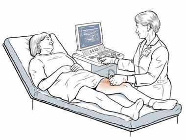 Diagnosing a Vein Problem Your doctor will evaluate the health of your veins. A health history and physical exam will be done. A special test called a duplex ultrasound may also be done.