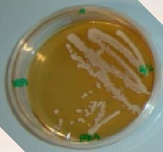Isolated from commercial baker s yeast