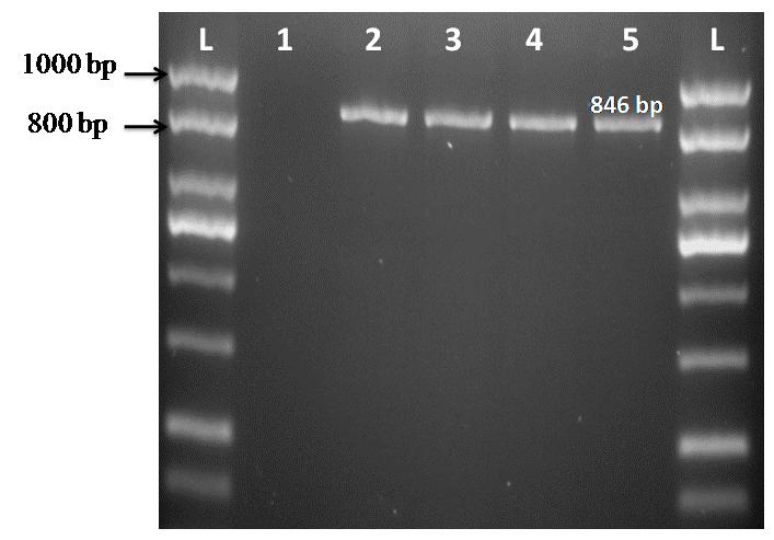 lin- Ether) and stained by acid-fast staining (AFS) and auramine phenol fluorescence (APF) for detection of Cryptosporidium oocysts.