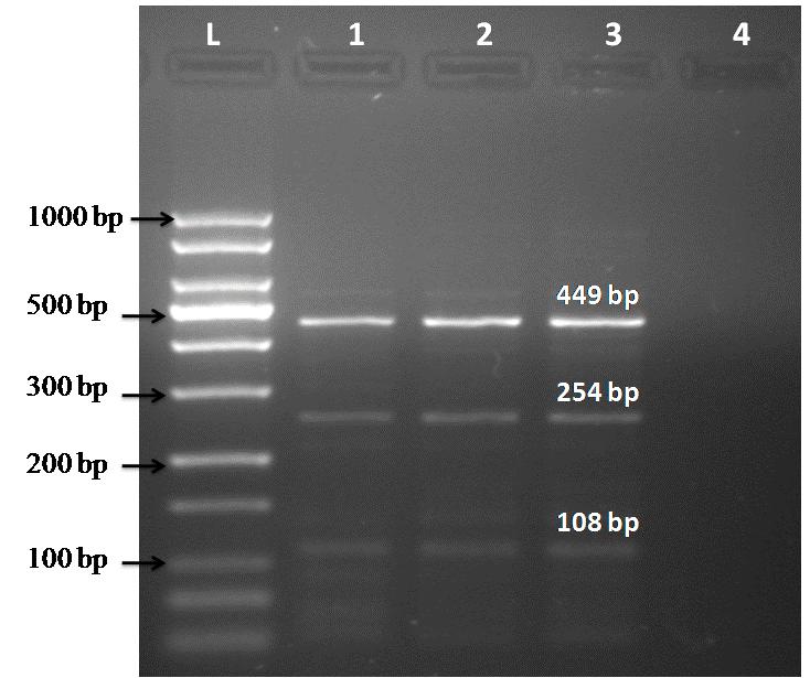 Gholami et al.: Cryptosporidium Infection The region SSU rrna based nested PCR- RFLP were used to characterize and corroborate of Cryptosporidium parasite.