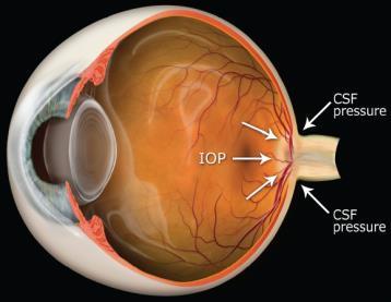 Spaceflight Associated Neuro-ocular Syndrome (SANS) Functional