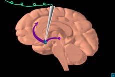 abuse bind to the neural circuitry of reward Self-stimulation studies