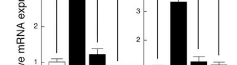 3. PGC-1α activates Notch signaling to inhibit endothelial migration Figure 3.3. PGC-1α activates Notch signaling to inhibit endothelial migration. (E) DAPT (2.