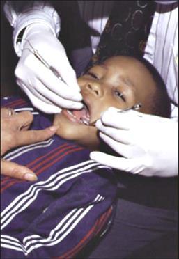 First Dental Exam The American Academy of Pediatric Dentistry