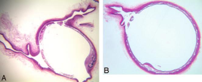 Fig 3. A, Photomicrograph (H&E; magnification, 20 ) of the vertebral artery. B, Photomicrograph (H&E; magnification, 25 ) of a lumbar artery.