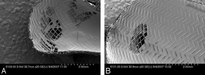 A, SEM photograph (magnification, 20 ) of the vertebral artery. B, An SEM of the ostium of the lumbar artery (magnification, 20 ).
