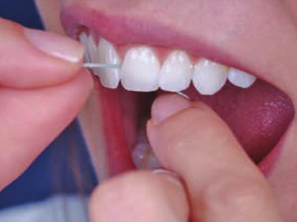 Use your thumbs and/ or index fingers to guide the floss between the teeth.