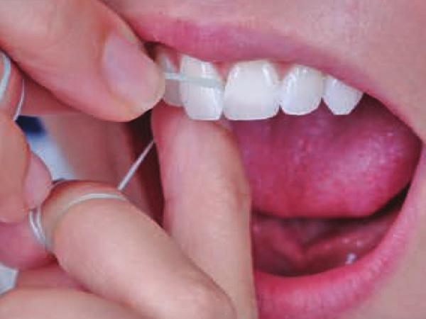 Wrap the floss around the tooth creating a C shape.
