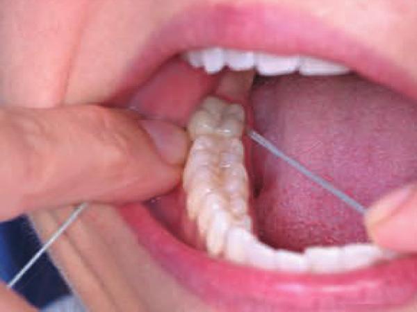 to remove food and germs. Next, wrap the floss around the next tooth and repeat.