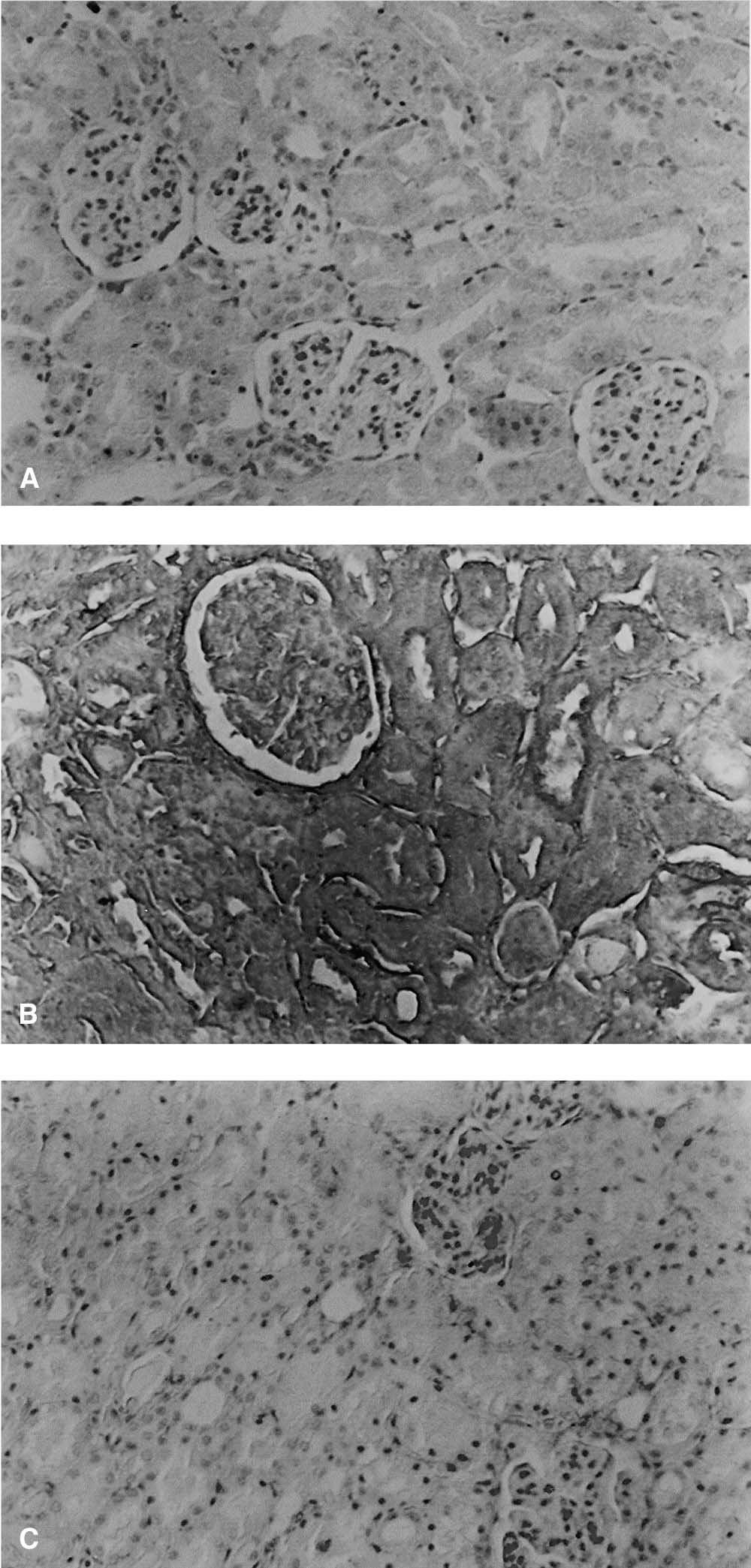 1612 Chatterjee et al: Tyrphostin AG126 reduces renal I/R injury Fig. 5.