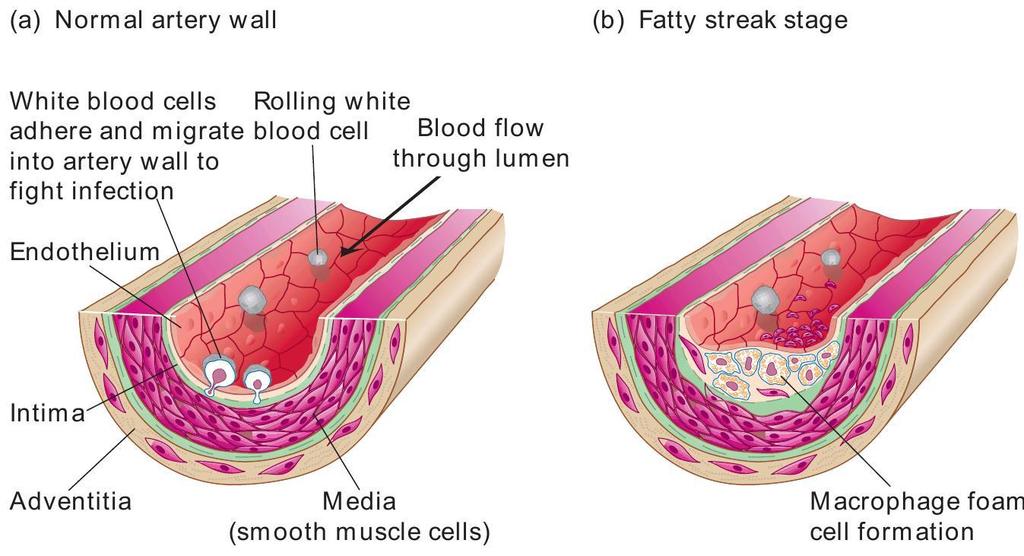 Normal Artery and Fatty Streak Stage Molecular Cell