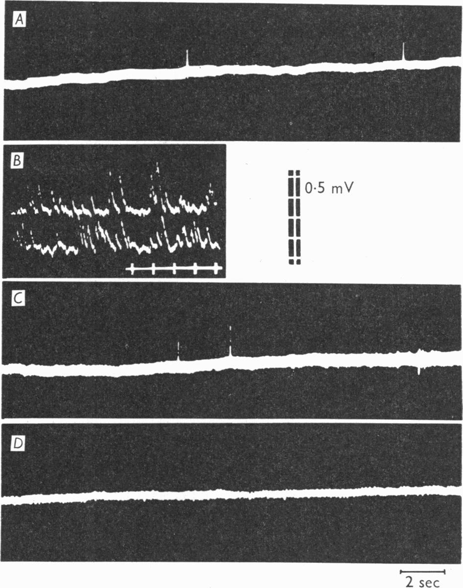 NEUROMUSCULAR JUNCTION IN MYASTHENIA GRA VIS 339 following the potassium application in the normal muscle, there was a marked increase in the frequency of m.e.p.p.s, but no such change was observed in muscles from patients with myasthenia gravis (Fig.