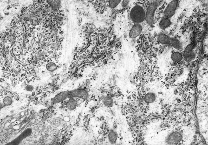 Electron micrograph of Nissl bodies