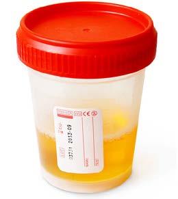 How does Urine Analysis factor in to Safety Decision Making? What does this cup tell you? Detectable use. 1) Have they used? 2) What they have used?