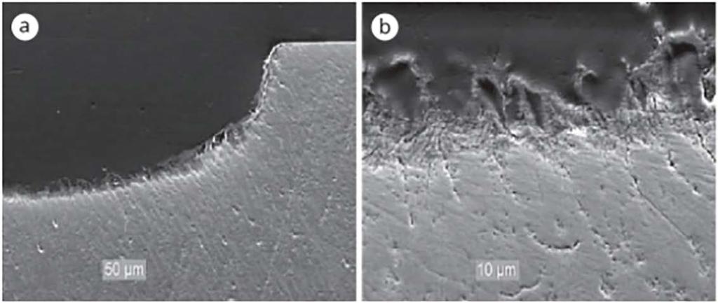 Figure 3. (a) SEM showing loss of enamel and, (b) at greater magnification, the softened layer at the advancing front of the lesion. Images courtesy of Karger.