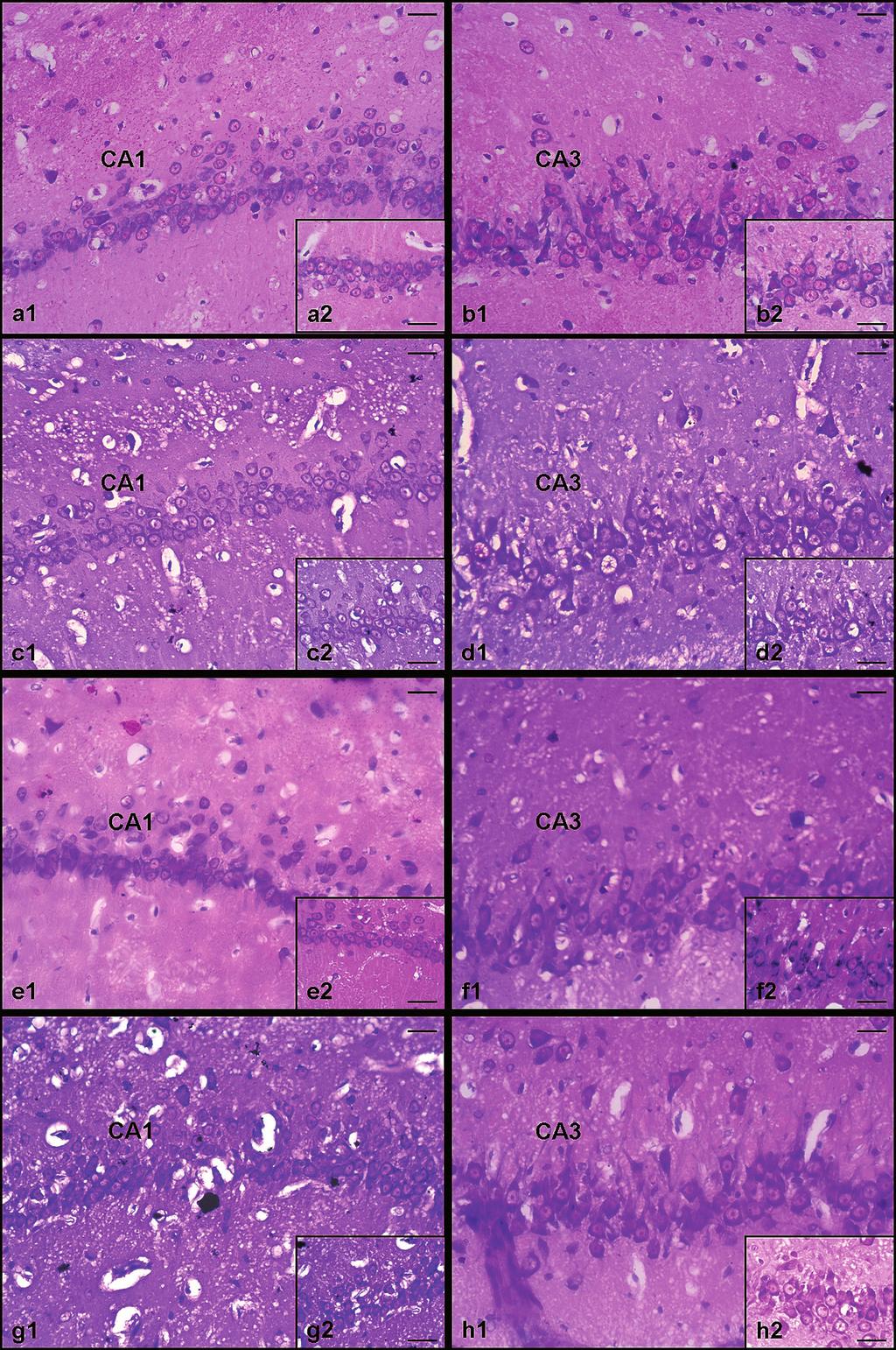 Adv Clin Exp Med. 2017;26(1):23 29 27 Fig. 1. CA1 and CA3 hippocampal regions were stained with Cresyl violet stain (x 40 and x 100 magnification).