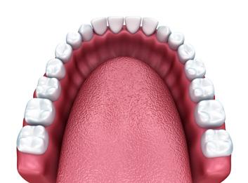 3. TEETH-IN-A-DAY IMPLANTS The Teeth-In-A-Day procedure provides a permanent solution to a frustrating situation.