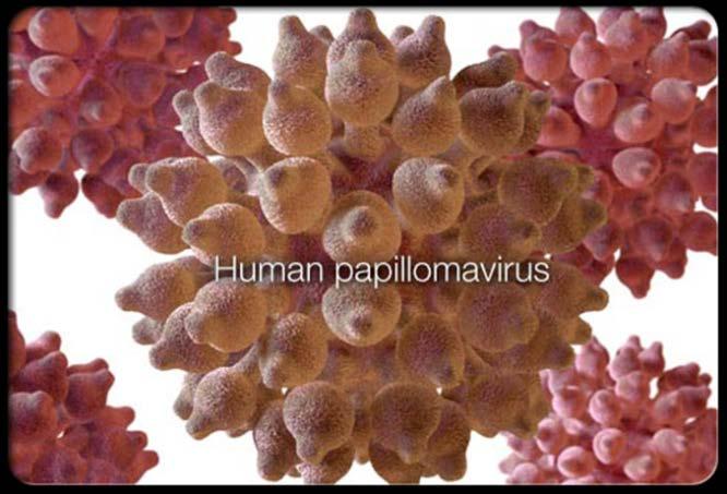 Human Papillomavirus (HPV) Of the +100 different types of HPVs - Over 40 types affect genital area. - High risk types (16,18) cause cancer. - Low risk types (6,11) cause genital warts.